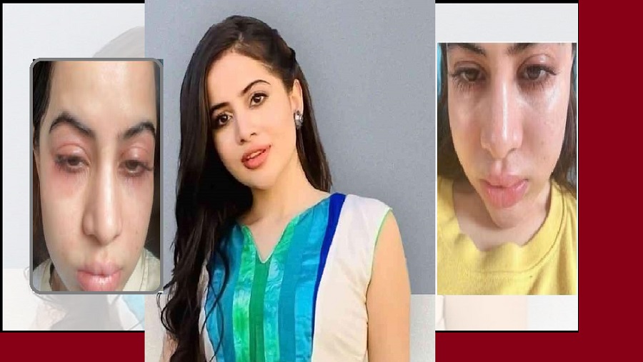 উরফি জাভেদ, চোখ, মুখ, ঠোঁট