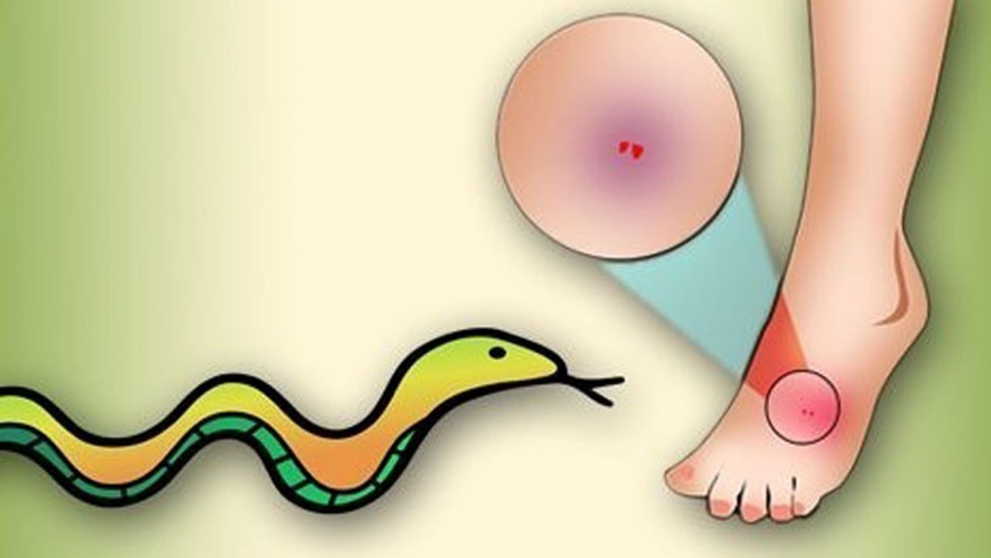 সাপের কামড়ে